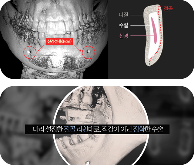 타병원 vs id 병원