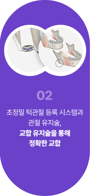 02 초정밀 턱관절 등록 시스템과 관절 유지술, 교합 유지술을 통해 정확한 교합